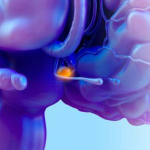 Growth Hormone Deficiency