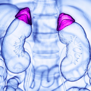 Cushing's Syndrome